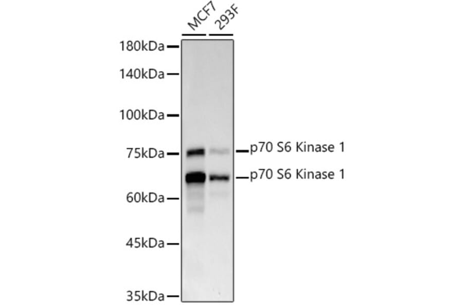 Western Blot - Anti-S6K1 Antibody [ARC57223] (A307700) - Antibodies.com