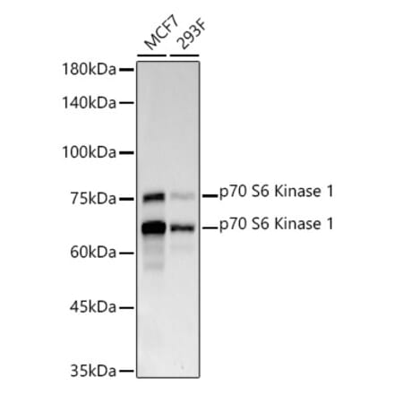 Western Blot - Anti-S6K1 Antibody [ARC57223] (A307700) - Antibodies.com