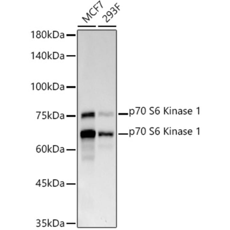 Western Blot - Anti-S6K1 Antibody [ARC57223] (A307700) - Antibodies.com
