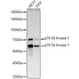 Western Blot - Anti-S6K1 Antibody [ARC57223] (A307700) - Antibodies.com