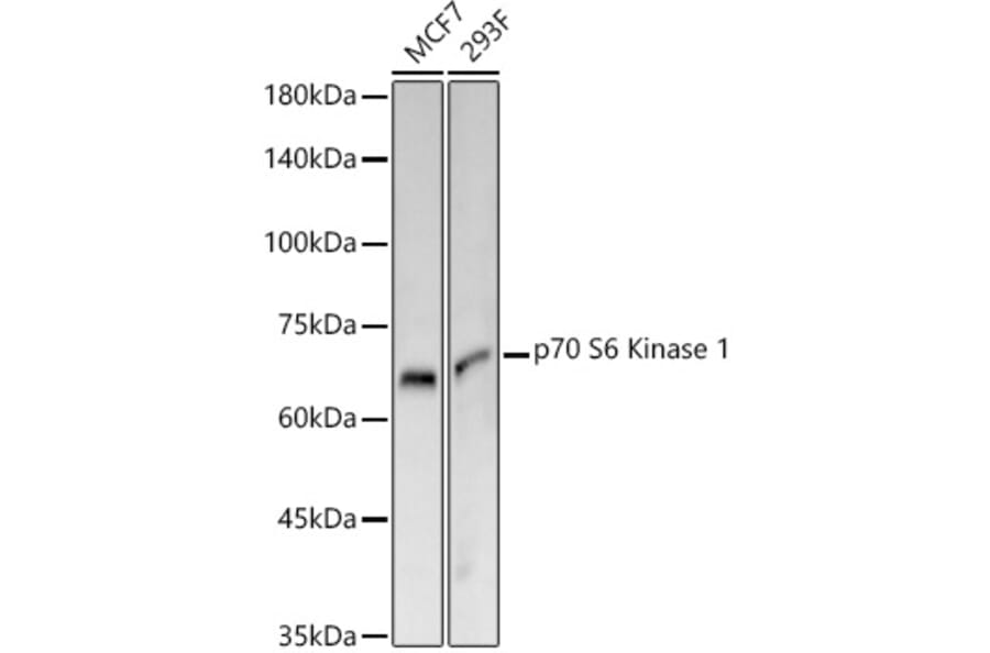 Western Blot - Anti-S6K1 Antibody [ARC57223] (A307700) - Antibodies.com