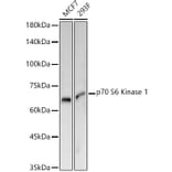 Western Blot - Anti-S6K1 Antibody [ARC57223] (A307700) - Antibodies.com