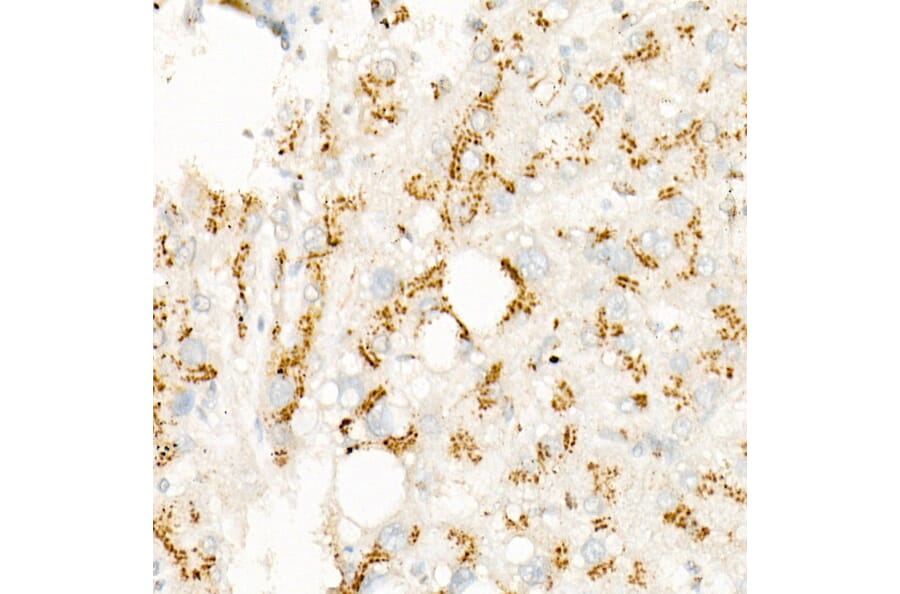 Immunohistochemistry - Anti-S6K1 Antibody [ARC57223] (A307700) - Antibodies.com