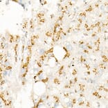 Immunohistochemistry - Anti-S6K1 Antibody [ARC57223] (A307700) - Antibodies.com