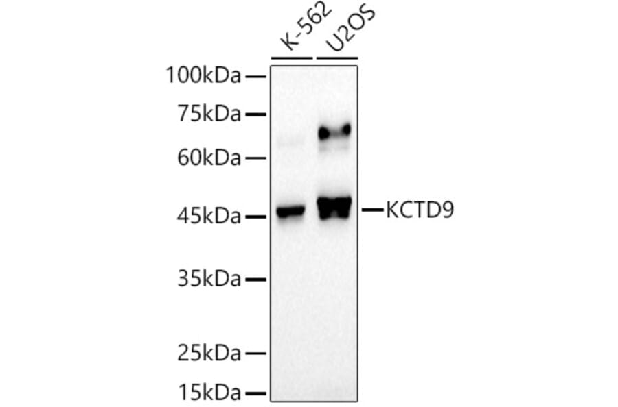 Western Blot - Anti-KCTD9 Antibody [ARC2956] (A307701) - Antibodies.com
