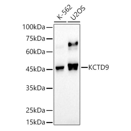 Western Blot - Anti-KCTD9 Antibody [ARC2956] (A307701) - Antibodies.com