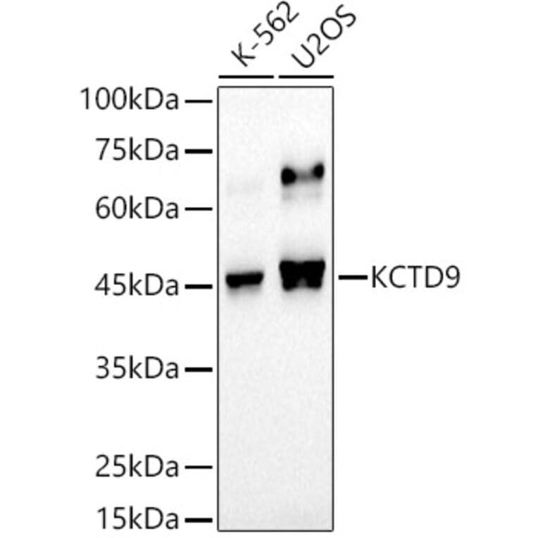 Western Blot - Anti-KCTD9 Antibody [ARC2956] (A307701) - Antibodies.com