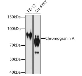 Western Blot - Anti-Chromogranin A Antibody [ARC1643] (A307702) - Antibodies.com