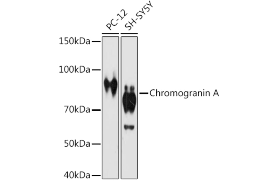 Western Blot - Anti-Chromogranin A Antibody [ARC1643] (A307702) - Antibodies.com
