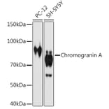 Western Blot - Anti-Chromogranin A Antibody [ARC1643] (A307702) - Antibodies.com