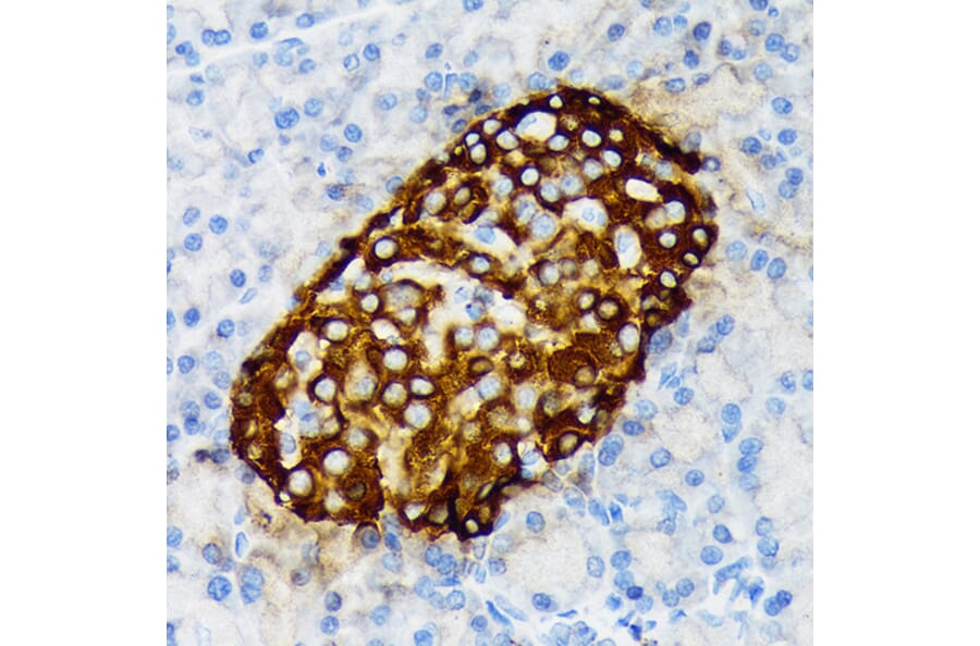 Immunohistochemistry - Anti-Chromogranin A Antibody [ARC1643] (A307702) - Antibodies.com