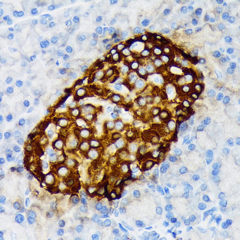 Immunohistochemistry - Anti-Chromogranin A Antibody [ARC1643] (A307702) - Antibodies.com