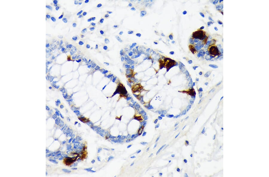 Immunohistochemistry - Anti-Chromogranin A Antibody [ARC1643] (A307702) - Antibodies.com