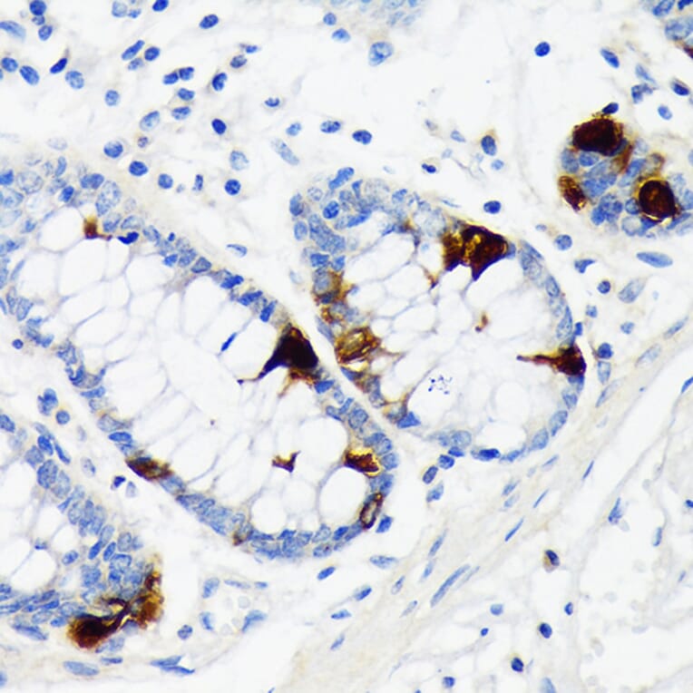 Immunohistochemistry - Anti-Chromogranin A Antibody [ARC1643] (A307702) - Antibodies.com