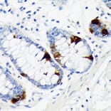 Immunohistochemistry - Anti-Chromogranin A Antibody [ARC1643] (A307702) - Antibodies.com