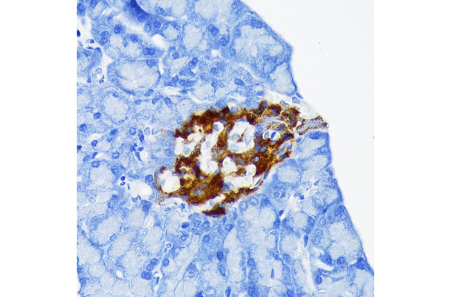 Immunohistochemistry - Anti-Chromogranin A Antibody [ARC1643] (A307702) - Antibodies.com