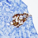 Immunohistochemistry - Anti-Chromogranin A Antibody [ARC1643] (A307702) - Antibodies.com