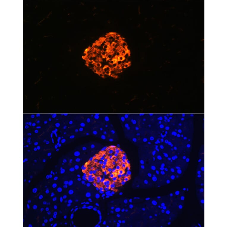 Immunofluorescence - Anti-Chromogranin A Antibody [ARC1643] (A307702) - Antibodies.com