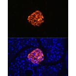 Immunofluorescence - Anti-Chromogranin A Antibody [ARC1643] (A307702) - Antibodies.com