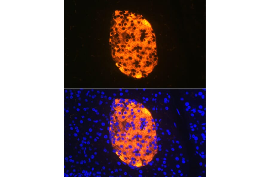 Immunofluorescence - Anti-Chromogranin A Antibody [ARC1643] (A307702) - Antibodies.com