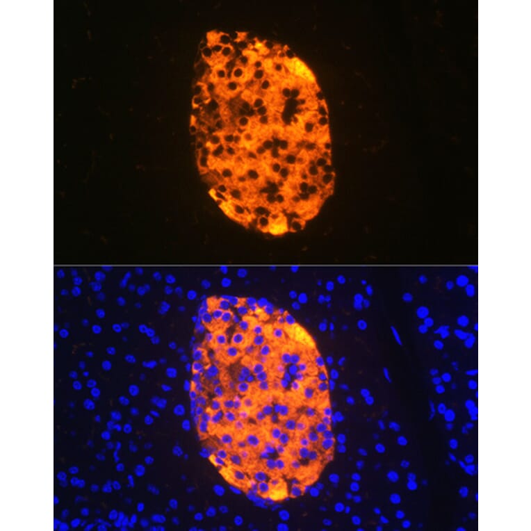 Immunofluorescence - Anti-Chromogranin A Antibody [ARC1643] (A307702) - Antibodies.com