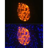 Immunofluorescence - Anti-Chromogranin A Antibody [ARC1643] (A307702) - Antibodies.com