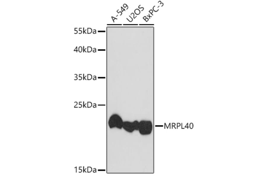 Western Blot - Anti-MRPL40 Antibody (A307703) - Antibodies.com