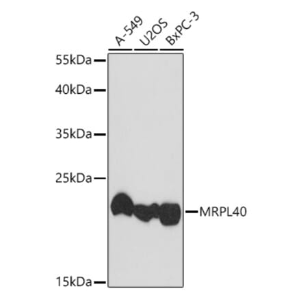 Western Blot - Anti-MRPL40 Antibody (A307703) - Antibodies.com