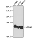 Western Blot - Anti-MRPL40 Antibody (A307703) - Antibodies.com