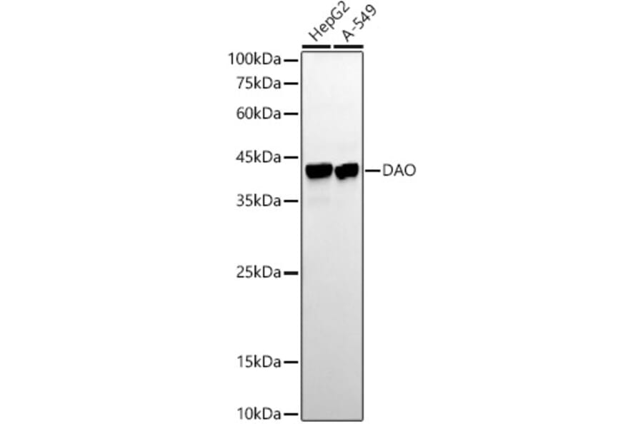 Western Blot - Anti-D Amino Acid Oxidase Antibody [ARC54988] (A307704) - Antibodies.com