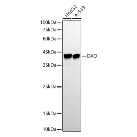 Western Blot - Anti-D Amino Acid Oxidase Antibody [ARC54988] (A307704) - Antibodies.com