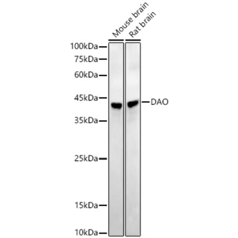 Western Blot - Anti-D Amino Acid Oxidase Antibody [ARC54988] (A307704) - Antibodies.com