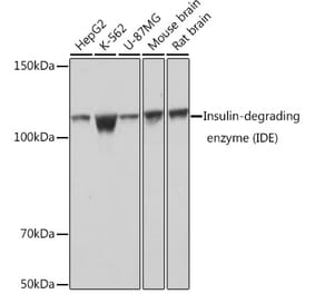 Western Blot - Anti-Insulin degrading enzyme / IDE Antibody [ARC0537] (A307705) - Antibodies.com