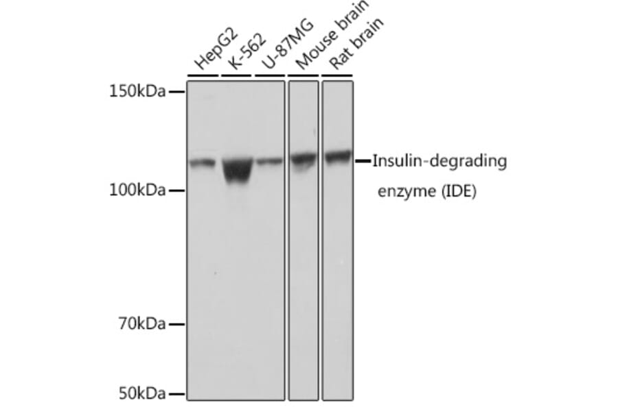 Western Blot - Anti-Insulin degrading enzyme/IDE Antibody [ARC0537] (A307705) - Antibodies.com