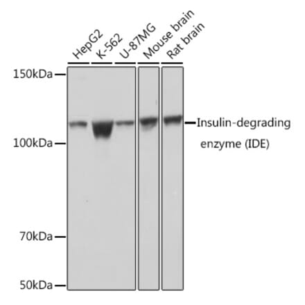 Western Blot - Anti-Insulin degrading enzyme / IDE Antibody [ARC0537] (A307705) - Antibodies.com