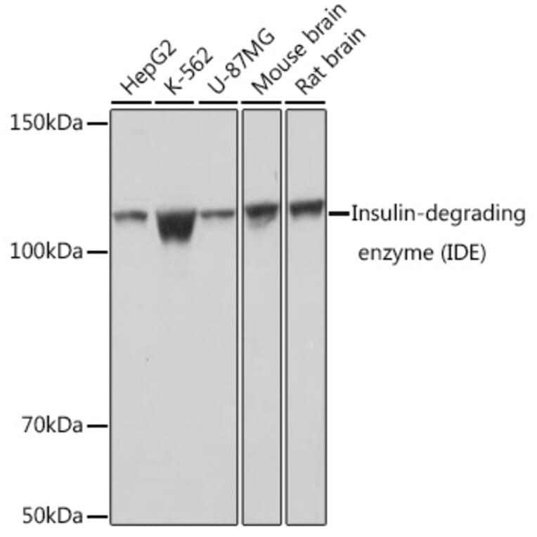 Western Blot - Anti-Insulin degrading enzyme/IDE Antibody [ARC0537] (A307705) - Antibodies.com