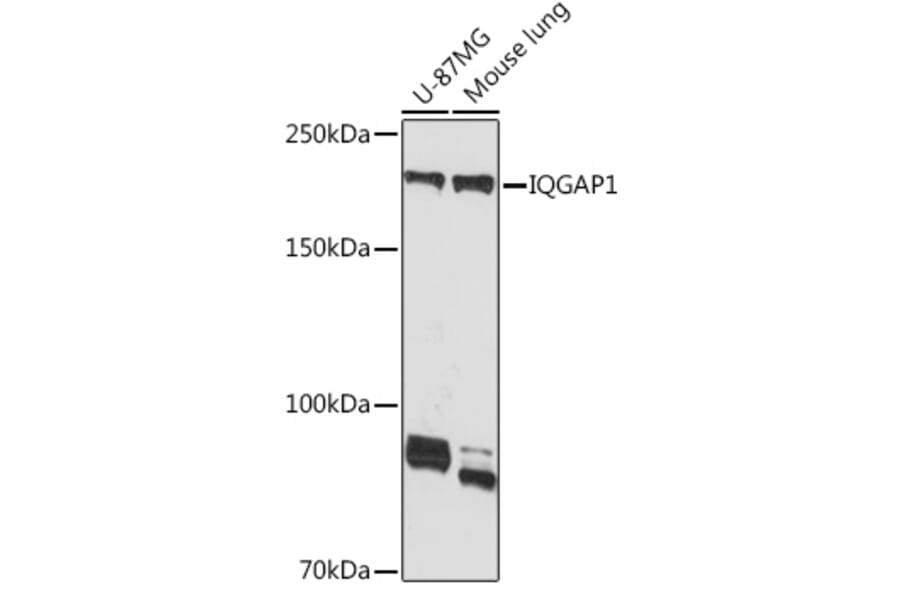 Western Blot - Anti-IQGAP1 Antibody [ARC1739] (A307706) - Antibodies.com