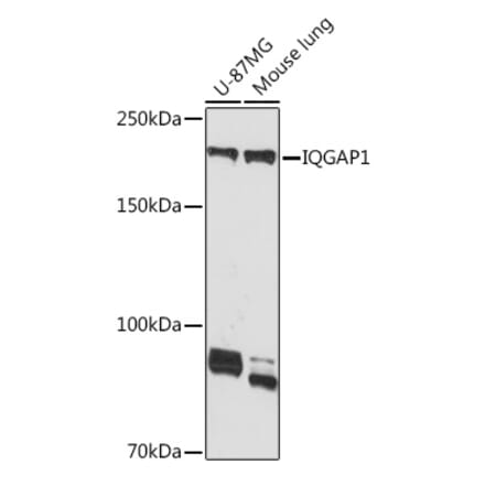 Western Blot - Anti-IQGAP1 Antibody [ARC1739] (A307706) - Antibodies.com