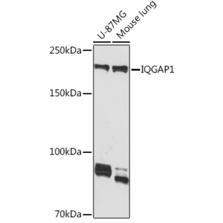 Western Blot - Anti-IQGAP1 Antibody [ARC1739] (A307706) - Antibodies.com