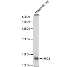 Western Blot - Anti-MPC2 Antibody (A307707) - Antibodies.com