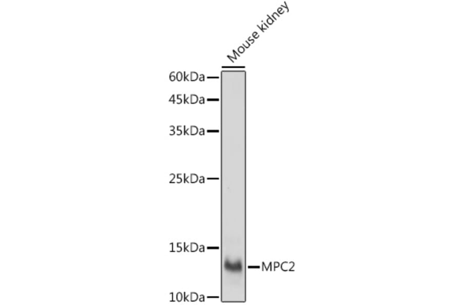 Western Blot - Anti-MPC2 Antibody (A307707) - Antibodies.com