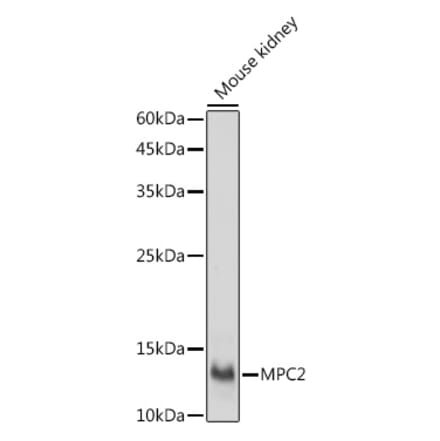 Western Blot - Anti-MPC2 Antibody (A307707) - Antibodies.com