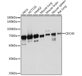 Western Blot - Anti-CDC40 Antibody [ARC2321] (A307708) - Antibodies.com