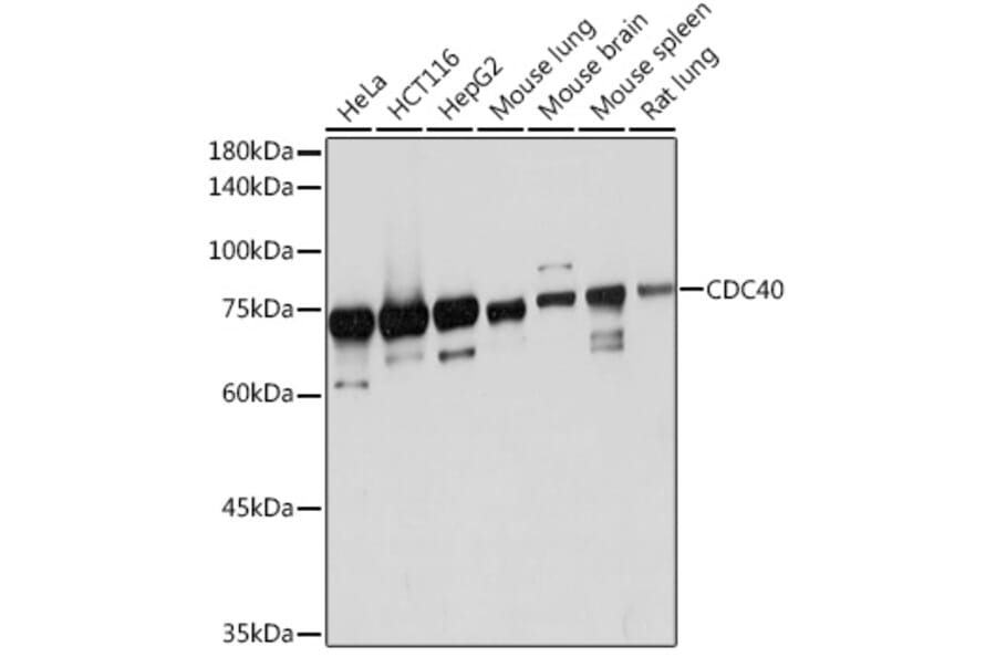 Western Blot - Anti-CDC40 Antibody [ARC2321] (A307708) - Antibodies.com