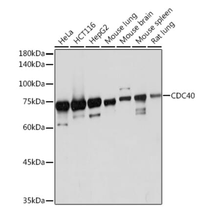 Western Blot - Anti-CDC40 Antibody [ARC2321] (A307708) - Antibodies.com
