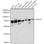 Western Blot - Anti-CDC40 Antibody [ARC2321] (A307708) - Antibodies.com