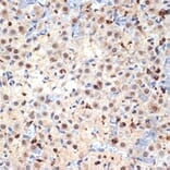 Immunohistochemistry - Anti-CDC40 Antibody [ARC2321] (A307708) - Antibodies.com