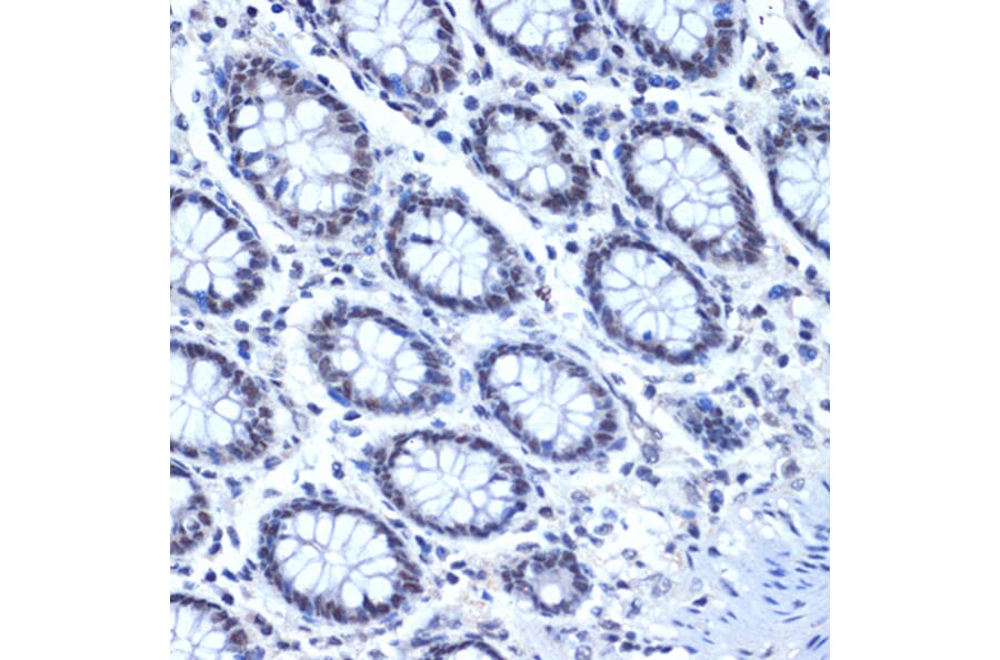 Immunohistochemistry - Anti-CDC40 Antibody [ARC2321] (A307708) - Antibodies.com