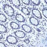 Immunohistochemistry - Anti-CDC40 Antibody [ARC2321] (A307708) - Antibodies.com