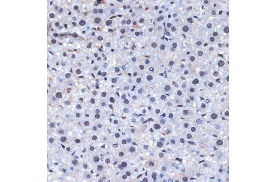 Immunohistochemistry - Anti-CDC40 Antibody [ARC2321] (A307708) - Antibodies.com